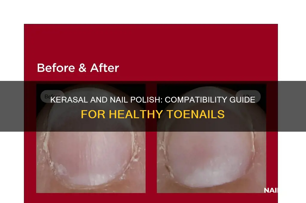 can you use kerasal with nail polish