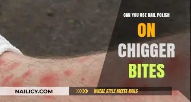 Nail Polish on Chigger Bites: Safe Remedy or Risky Myth?