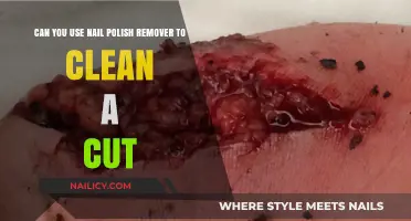 Using Nail Polish Remover: Safe for Cleaning Wounds?