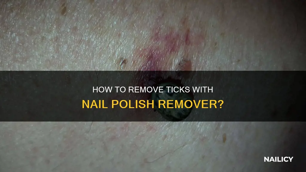 can you use nail polish remover to remove a tick