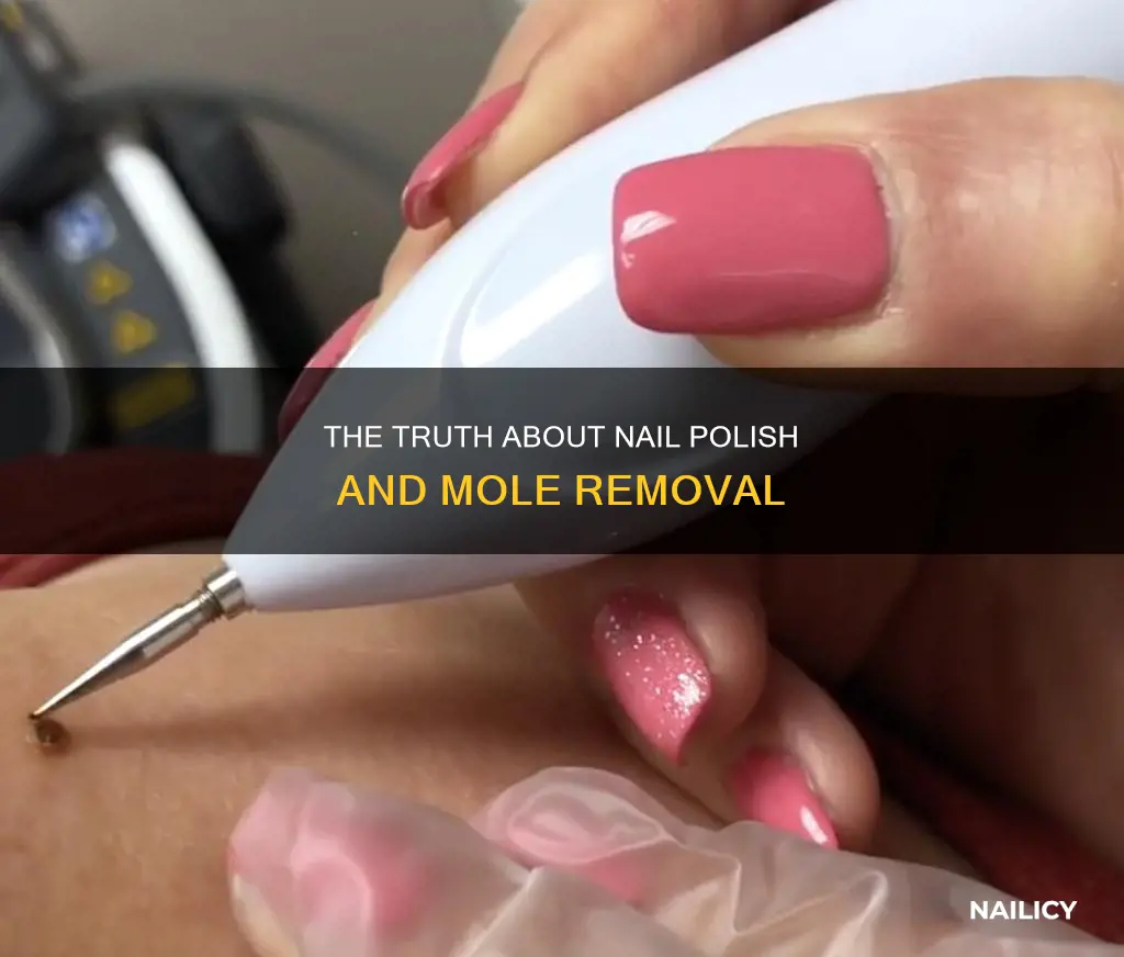 can you use nail polish to remove moles