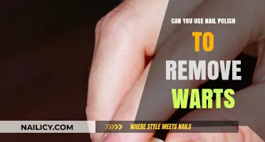 How Nail Polish Can Remove Warts