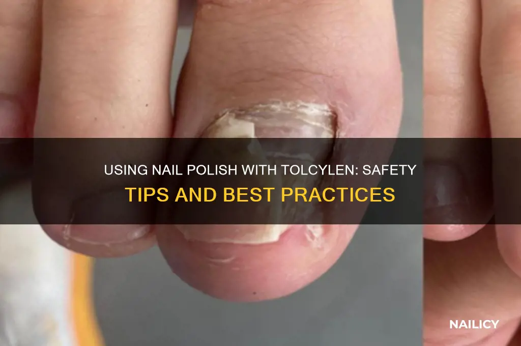 can you use nail polish with tolcylen