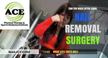 Walking Post-Tibial Nail Removal Surgery: What to Expect