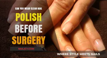 Clear Nail Polish Before Surgery: Safe or Not?