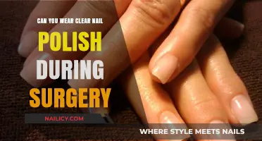 Clear Nail Polish in the OR: Safe or Surgical No-Go?