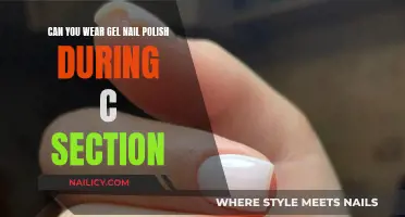 Gel Nail Polish During C-Section: Safe or Not?