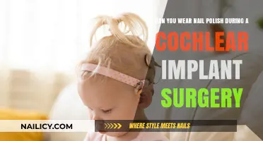 Nail Polish and Cochlear Implant Surgery: What You Need to Know