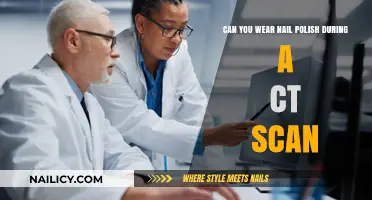 Nail Polish and CT Scans: Safe to Wear or Remove?