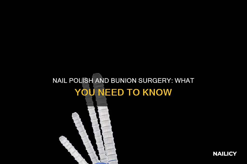 can you wear nail polish during bunion surgery