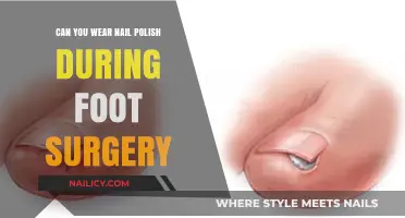 Nail Polish and Foot Surgery: What You Need to Know