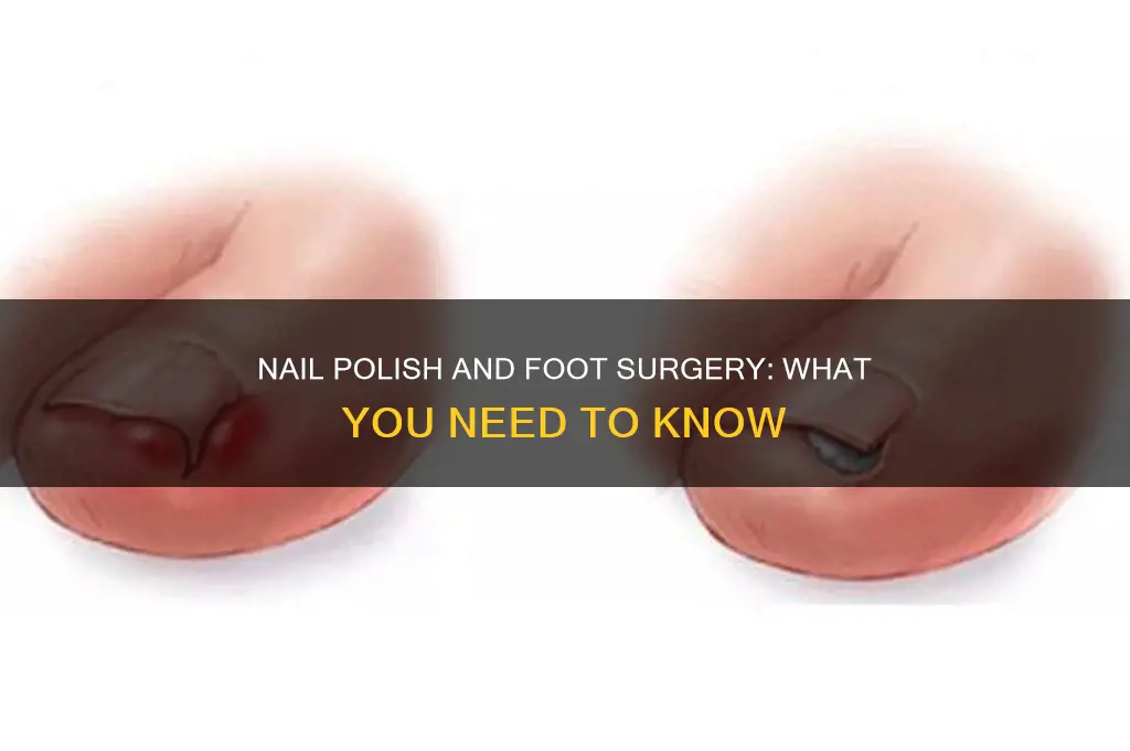 can you wear nail polish during foot surgery