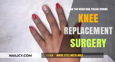 Nail Polish and Knee Surgery: What You Need to Know
