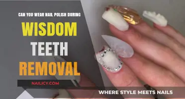 Wisdom Teeth Removal: Can You Wear Nail Polish?