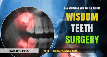 Wisdom Teeth Surgery and Nail Polish: What You Need to Know