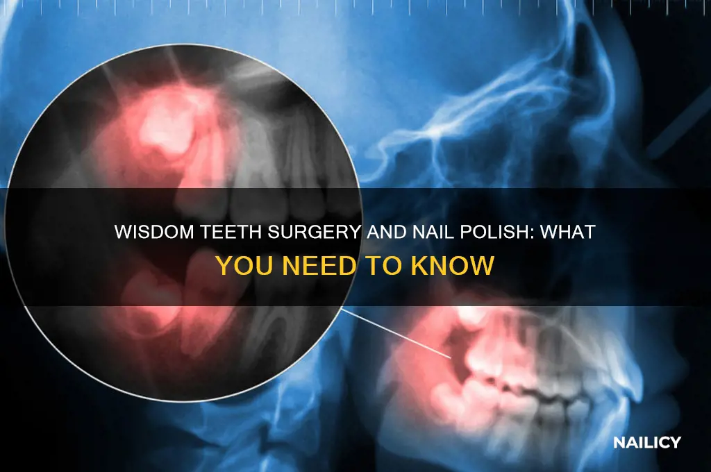 can you wear nail polish during wisdom teeth surgery