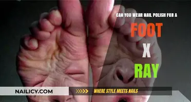 Nail Polish and Foot X-Rays: What You Need to Know
