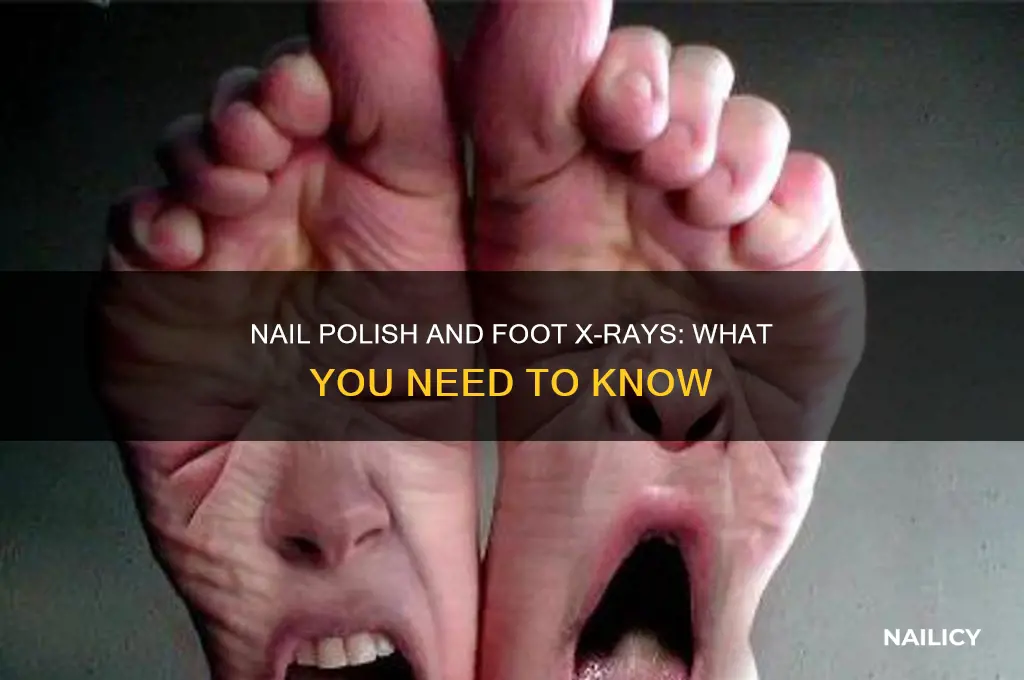 can you wear nail polish for a foot x ray