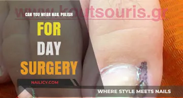Nail Polish and Day Surgery: What You Need to Know