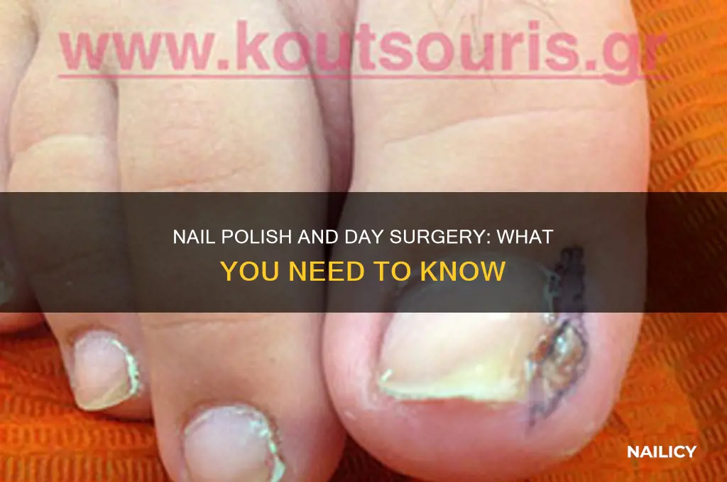 can you wear nail polish for day surgery