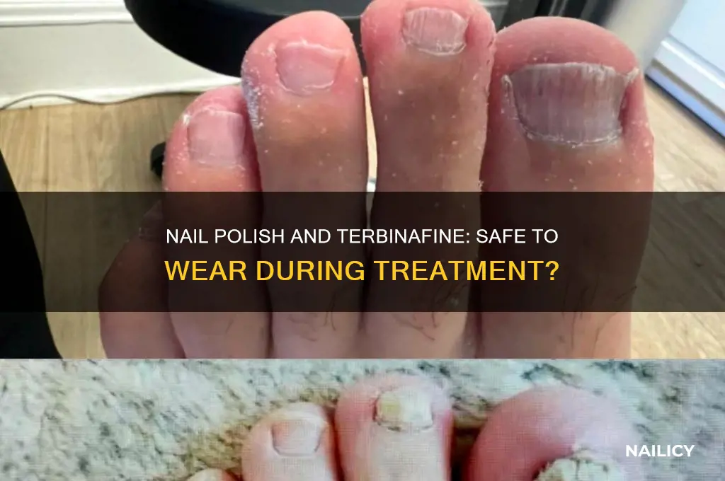 can you wear nail polish while taking terbinafine