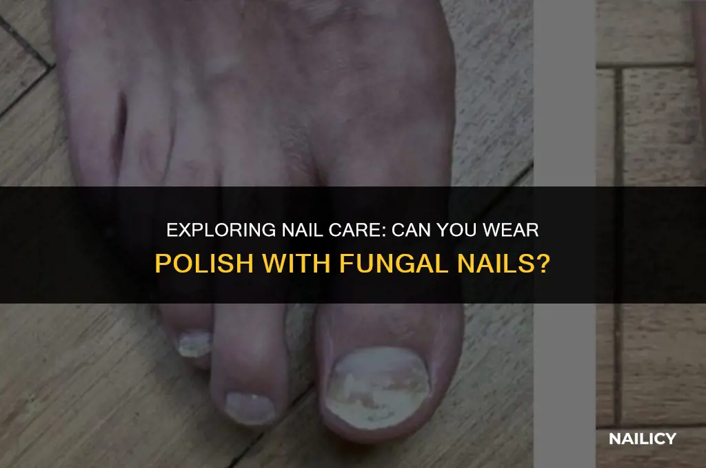 can you wear nail polish while using fungi nail