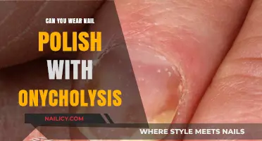 Nail Polish and Onycholysis: Safe to Wear or Risky Choice?