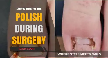Can You Wear Toenail Polish During Surgery? Pre-Op Beauty Tips