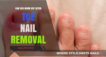 Toe Nail Removal: Safe to Work Out?
