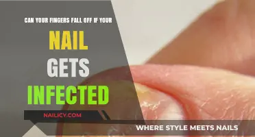 The Surprising Truth About Infected Nails and Finger Health