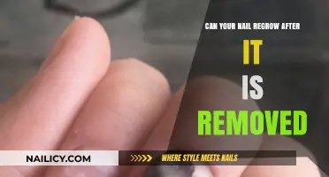 How Nails Regrow After Being Removed