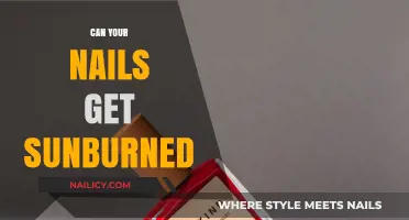 Sun-Kissed or Sun-Scorched? The Truth About Nail Sunburns