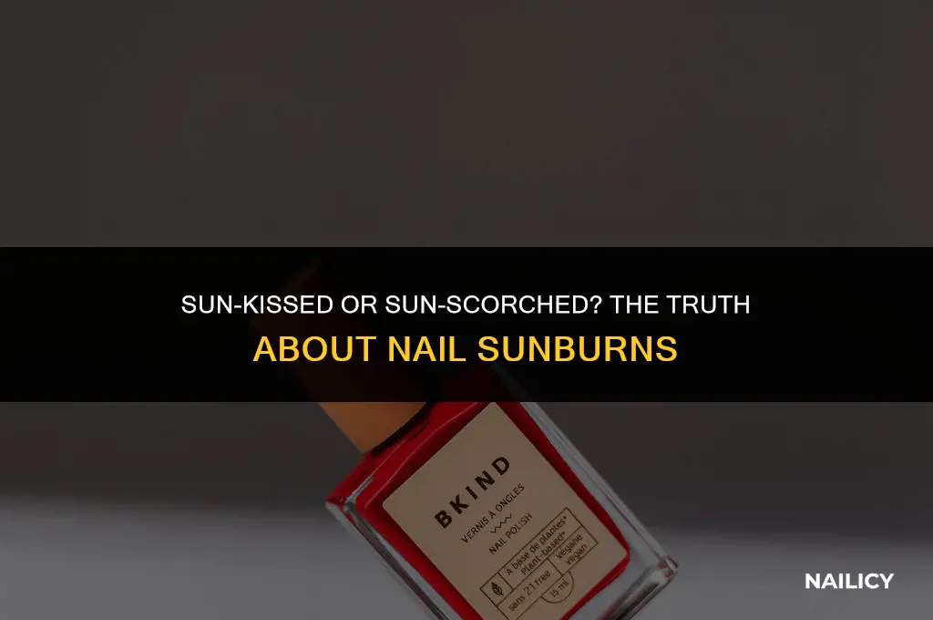 can your nails get sunburned