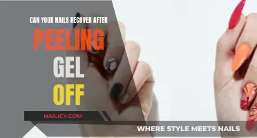 Gel Nail Recovery: Peeling Off and Healing Process
