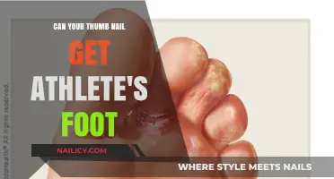 Can Your Thumbnail Get Athlete's Foot? Myths and Facts Uncovered