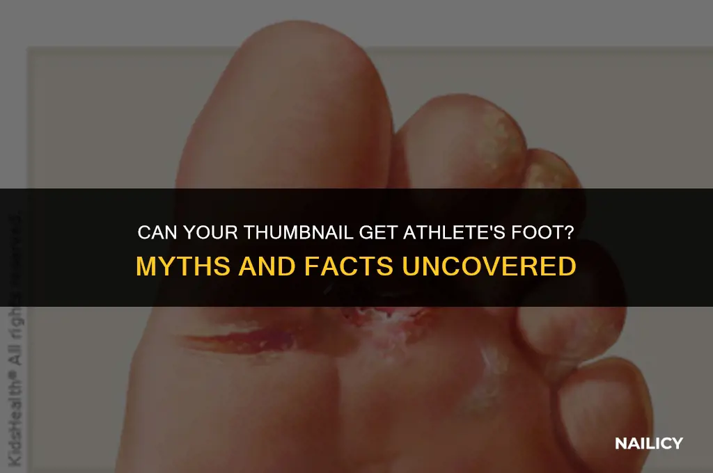 can your thumb nail get athlete