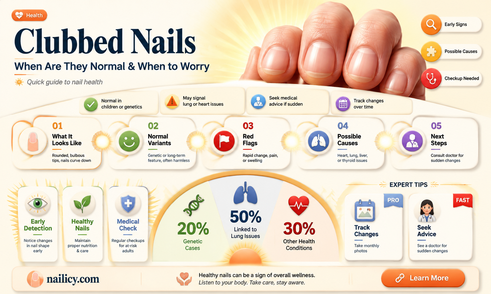 are clubbed nails ever ok