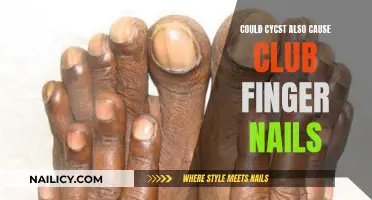 Cystic Fibrosis: Unraveling the Mystery of Clubbed Nails