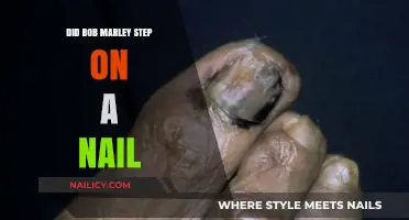 Bob Marley's Nail Injury: Unraveling the Truth Behind the Legend