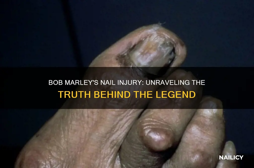 did bob marley step on a nail