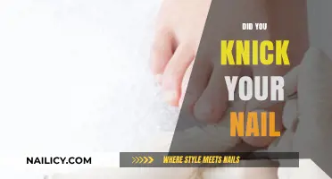 Ouch! Did You Knick Your Nail? Quick Fixes and Prevention Tips