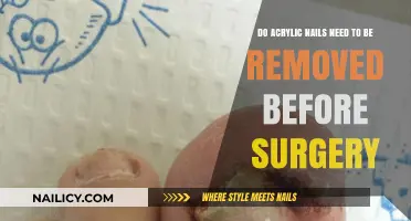 Acrylic Nails and Surgery: Is Removal Necessary?