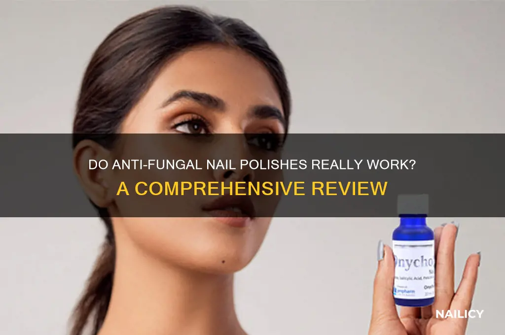 do anti fungal nail polishes work