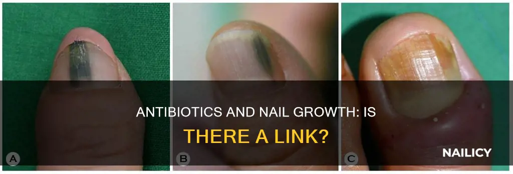 do antibiotics make your nails grow