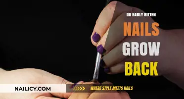 How to Regrow Nails After Biting Them