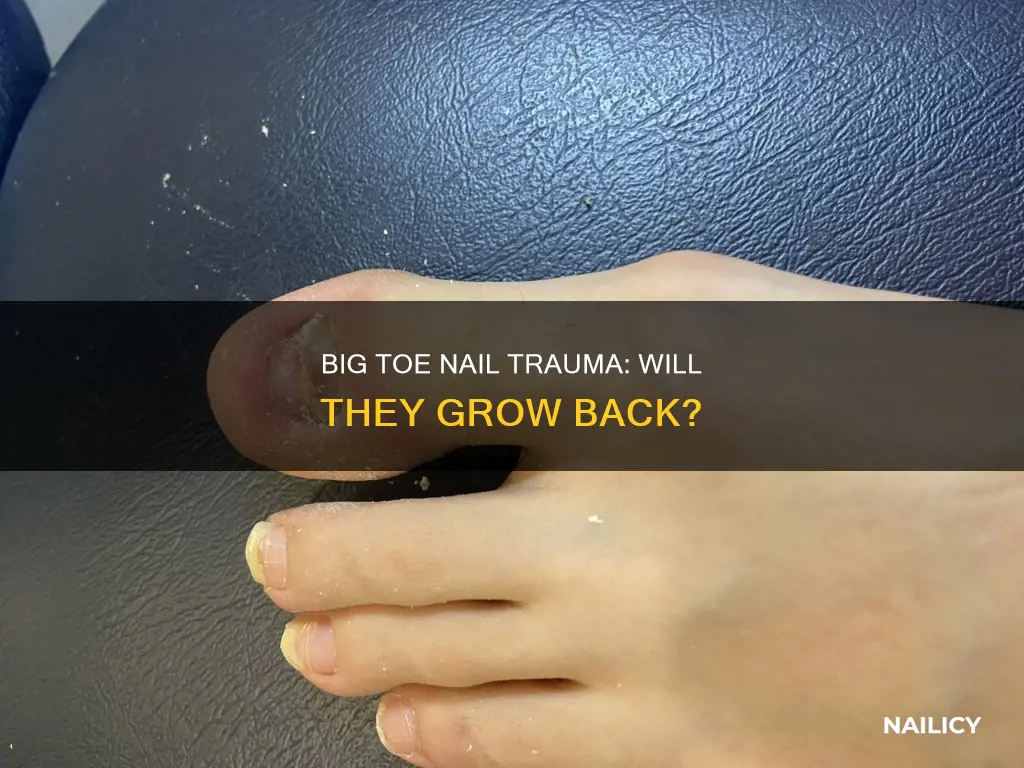 do big toe nails grow back