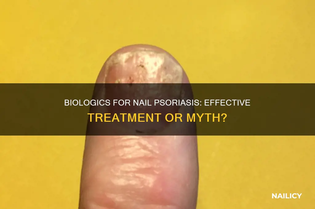 do biologics treat nail psoriasis