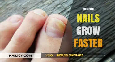 Bitten Nails: Do They Grow Faster?