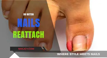 Can Bitten Nails Reattach? Healing and Regrowth Tips Revealed