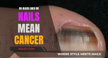 Black Nail Lines: Cancer Warning Signs or Something Else?